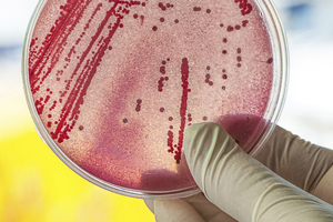 UK: £5M boost to superbug researchers