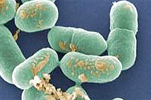 AMI concerned: USDA guidelines for Listeria control