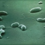 Campylobacter detection medium now available