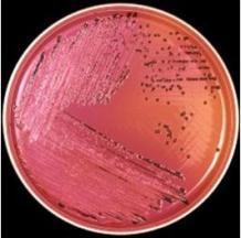 Research: salmonella bacteria to kill cancer