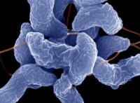 Scientists meet to tackle Campylobacter