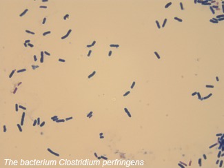 Enteric diseases with special attention to Clostridium perfringens