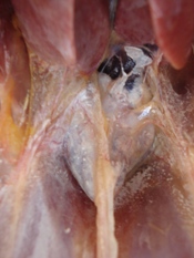 Kidney damage is emerging in laying hens